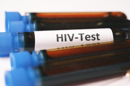 Warna Sperma HIV: Kesalahan Umum dan Cara Menghindarinya - warna sperma hiv